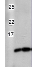 TrxM1/M2 | Thioredoxin M1/M2 (chloroplastic) in the group Antibodies Plant/Algal / Photosynthesis / RUBISCO/Carbon metabolism at Agrisera AB (Antibodies for research) (AS14 2809)